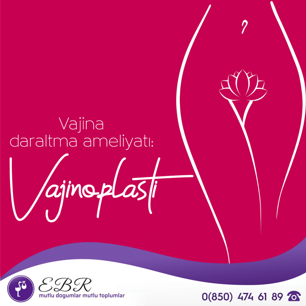 Vajina daraltma ameliyatı: Vajinoplasti