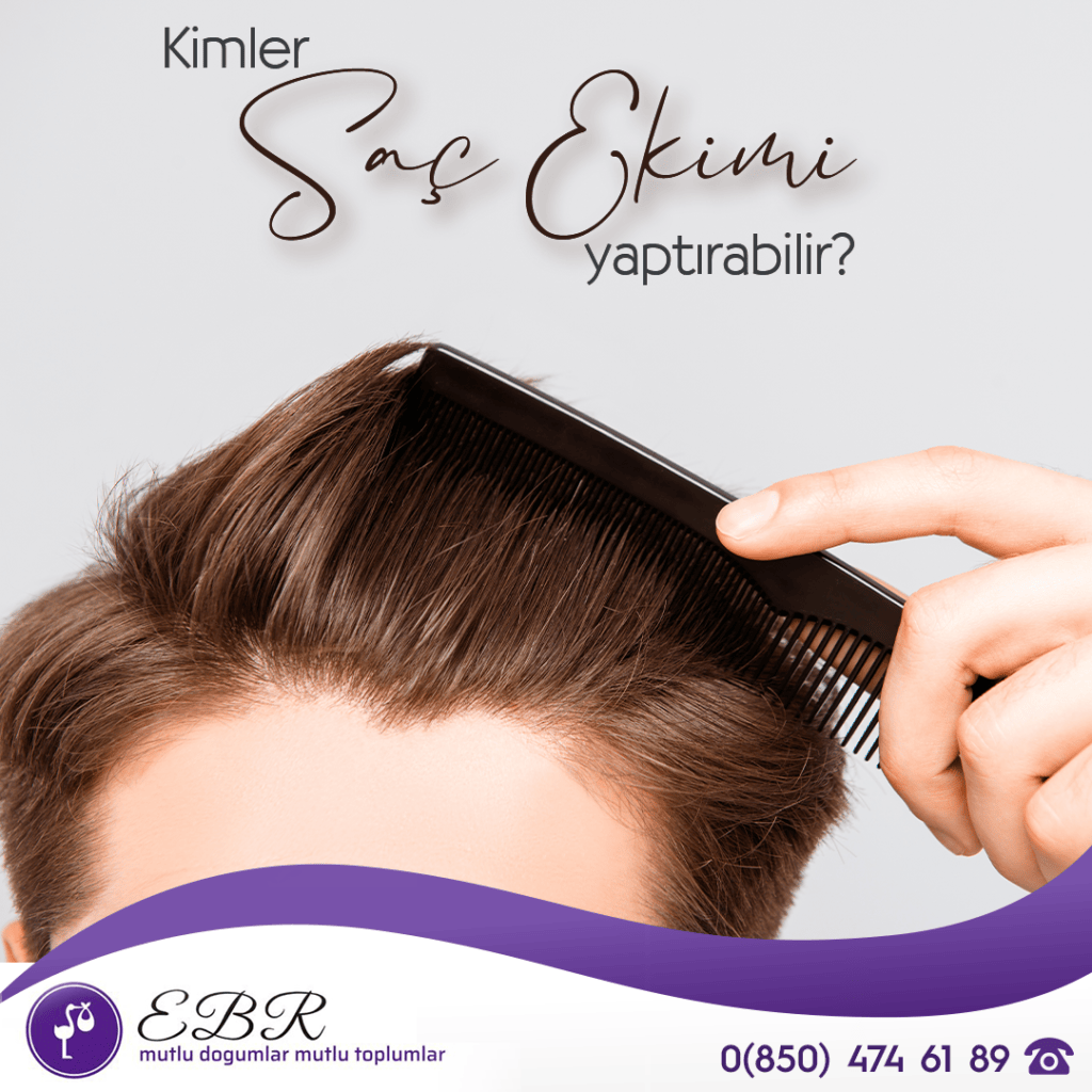 Kimler Saç ekimi yaptırabilir?