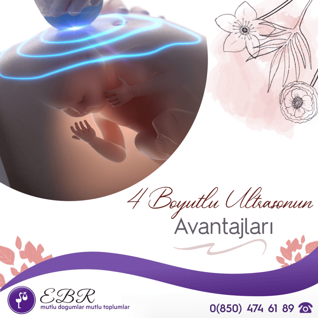 4 Boyutlu Ultrasonun Avantajları