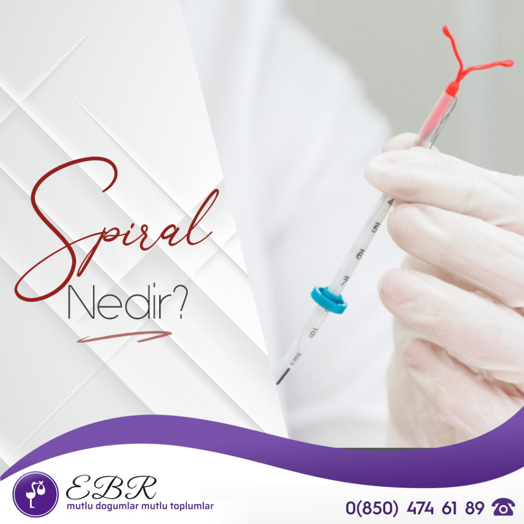 Spiral Nedir?