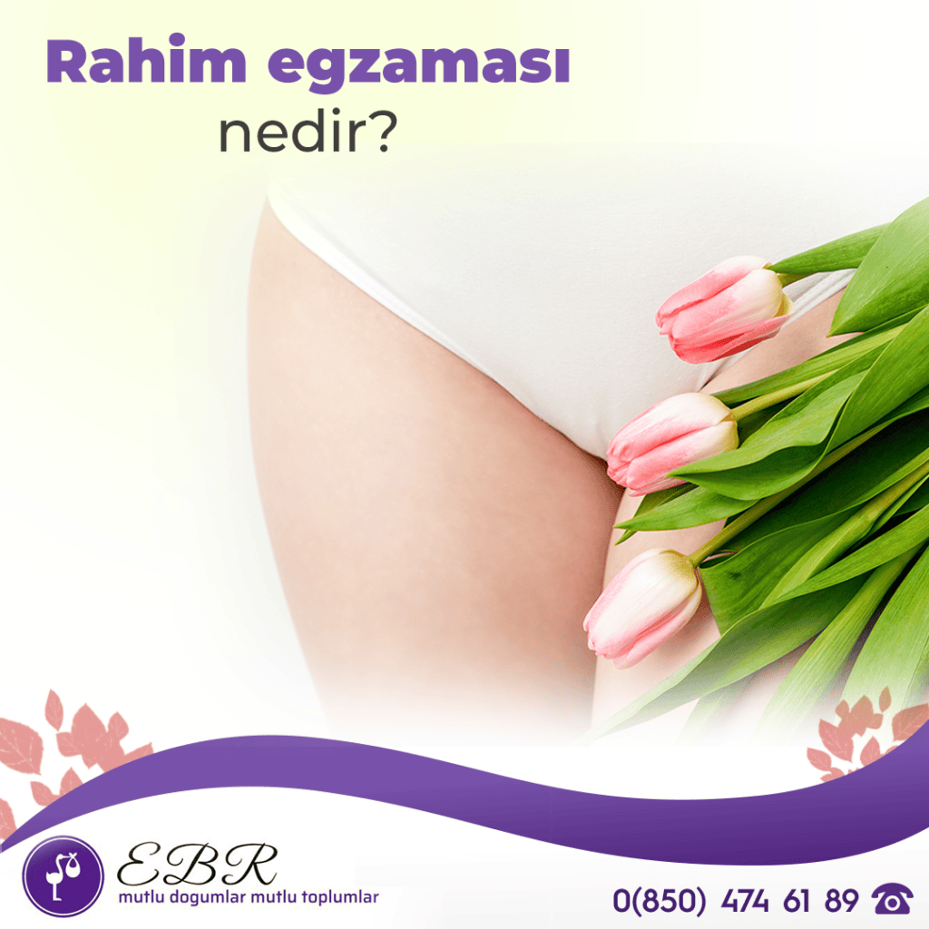 Rahim egzeması nedir?