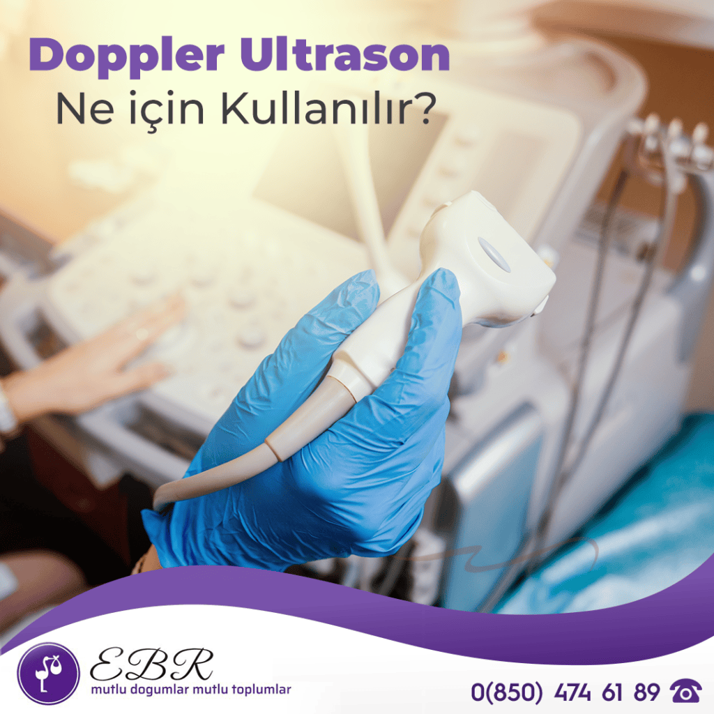 Doppler Ultrason Ne için Kullanılır?