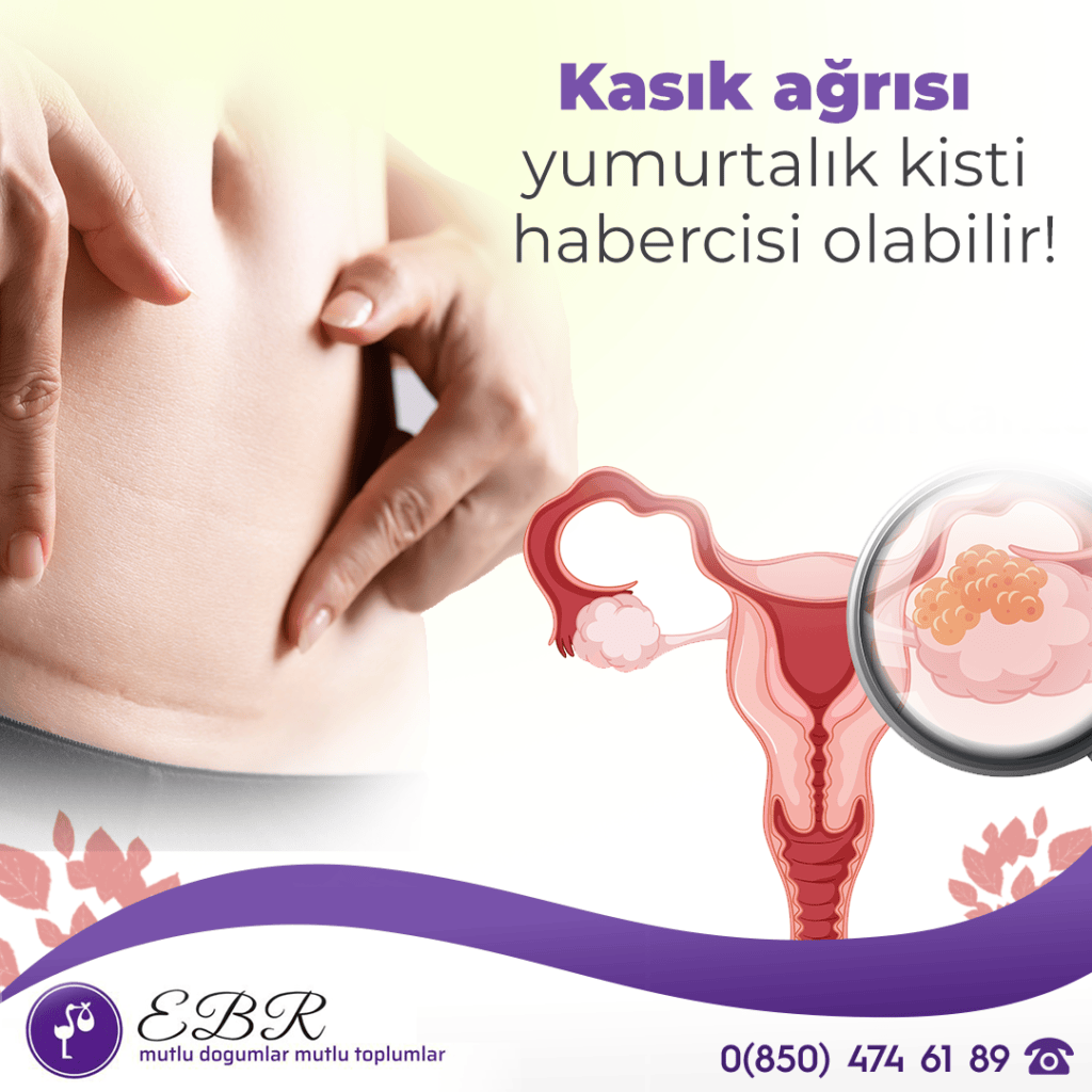 Kasık ağrısı ve adet düzensizliği yumurtalık kisti belirtisi olabilir!