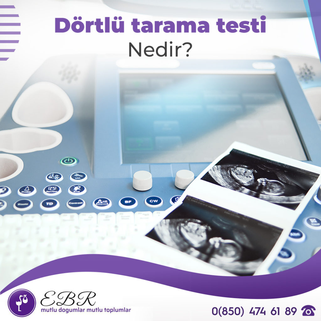 Dörtlü tarama testi nedir?