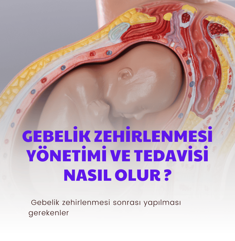 Gebelik Zehirlenmesi Yönetimi Ve Tedavisi Nasıl Olur ?